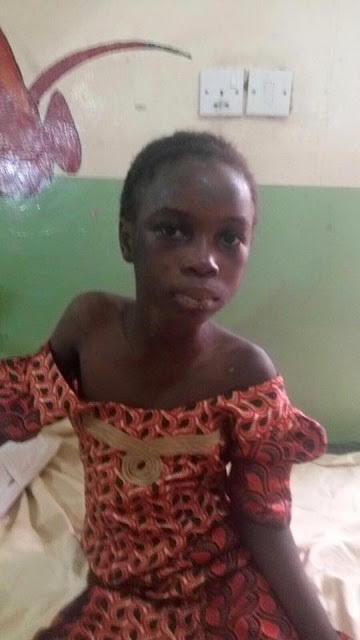 Pics: Evil Stepmother Slashes, Burns Girl after Killing her Mother & Sister in Gombe State
