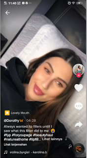 Lip Filler filter tiktok - Cara Menemukan dan Mendapatkan Lip Filler Filter di TikTok