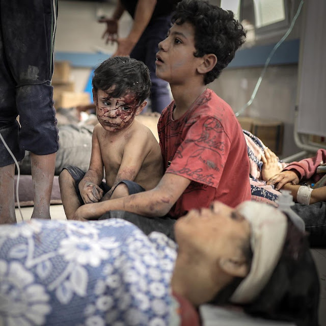 A little boy in a Gaza hospital as he and his brother survived the Israeli shelling of three houses in the enclave on 23 October by Belal Khaled