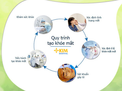 Cắt khóe mắt bao nhiêu tiền