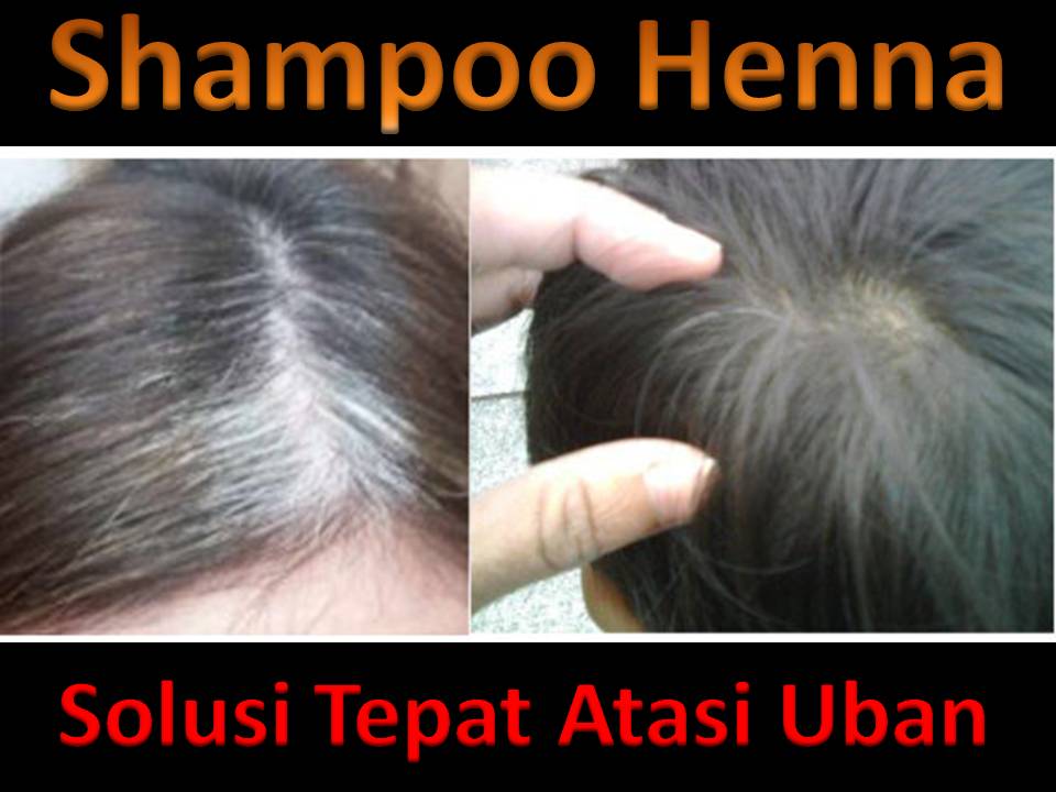 TIPS DIET PELANGSING PENYEBAB CARA MENGATASI RAMBUT UBAN