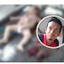 Doktor Muda Ni Bedah Mayat Bayi. Apa Yang Ditemui Buat Ramai TERPANA !!! Aku ditugaskan di bahagian forensik hari tu. Datang mayat bayi yang dah hijau, kepala lembik macam jeli. Demi tugas, aku buat juga bedah siasat. Aku nak nangis bila mengetahui bahawa bayi itu telah....