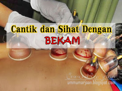 cantik, sihat, bekam, sunnah