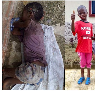 See Before & After Photos Of Akwa Ibom Boy Abandoned To Die For Being A 'Wizard'