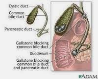 Obat Batu Empedu