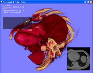 GPU volume rendering of liver dataset