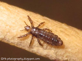 Head Lice Picture