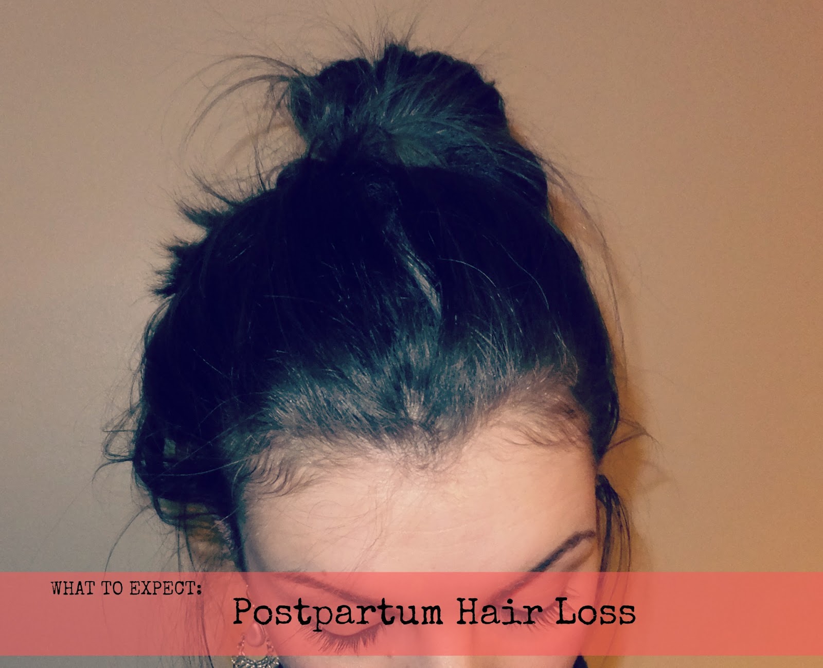 Fern Blush Postpartum Hair Loss What To Expect