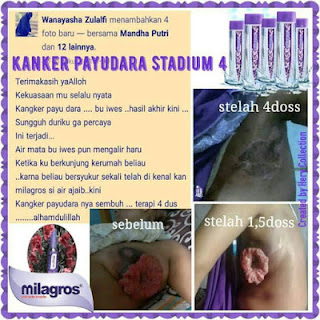 Milagros Untuk Kanker Payudara