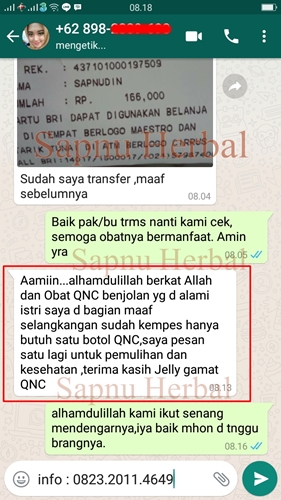 Obat Bengkak di Selangkangan Sebelah Kanan / Kiri Yang Manjur