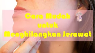 Cara mudah untuk menghilangkan jerawat