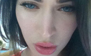 Megan Fox Botox