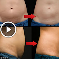 How To Loose 10 Kg In 10 Days With This 4 Ingredient