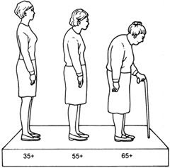 best way overcome bone fragility in the elderly