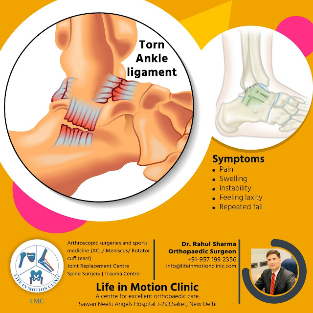 Dr. Rahul Sharma Torn Ankle Ligament surgeon near me