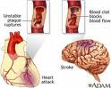 arterial plaque affecting the brain and heart