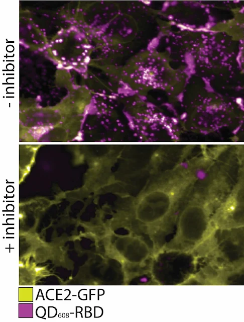 Image Attribute: In this figure, the top panel shows ACE2-GFP (yellow) expressing cells binding and internalizing QD608-RBD (magenta). In the bottom panel, an inhibitor is added to prevent binding of QD608-RBD to ACE2-GFP, and the presence of ACE2-GFP on the cell surface is strong with little to no QD608-RBD visible. Scientists at NRL and NCATS, published their findings in ACS Nano on their collaboration to develop SARS-CoV-2 nanoparticle probes. / Source: U.S. NRL