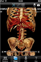 Sistema osirix de visión de imágenes DICOM