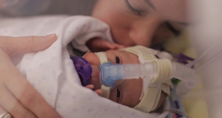 Watch: Dad's Film Shows Premature Baby's Miraculous Recovery!