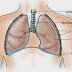 Pleural Mesothelioma – Cancer of the Lung Lining