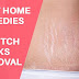 Best Home Remedies for Stretch Marks Removal Naturally