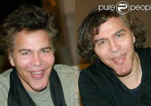 BlogPerghh: perghh! plastic surgery to another scary level!