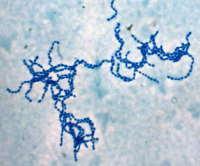 Xoắn khuẩn Leptospiral gây bệnh Lepto