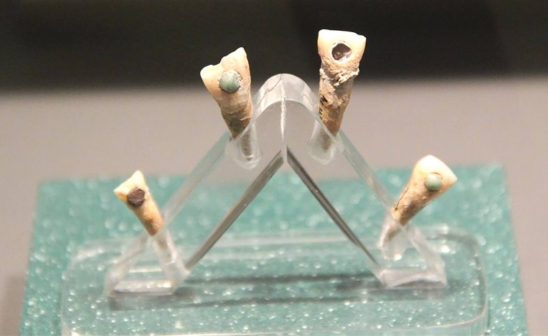 Los mayas usaron implantes dentales para proteger sus dientes de las caries