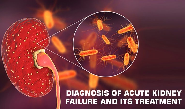 Diagnosis of acute kidney failure and its treatment