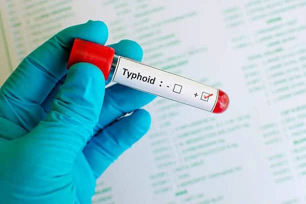 What Is Typhoid? How Typhoid Spread & Treatment  - Health-Teachers