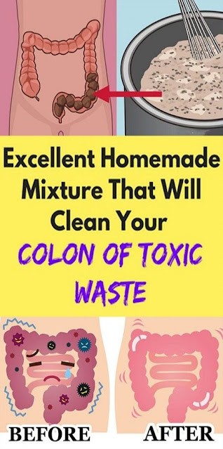 Homemade Mixture That Will Clean Your Colon Of Toxic Waste