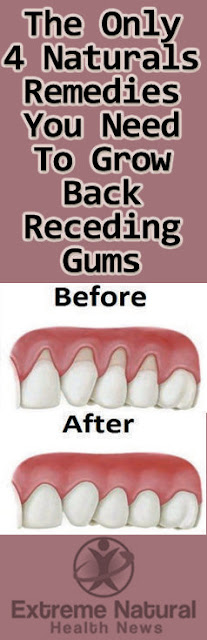 THE ONLY 4 NATURAL REMEDIES YOU NEED TO GROW BACK RECEDING GUMS