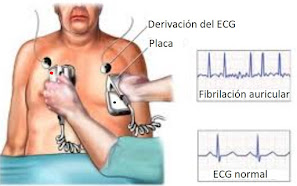 https://institutoeuropeo.es/articulos/blog/cardioversion-y-desfibrilizacion/