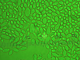 Microbes isolated from De Dolle Oerbier Special Reserva.