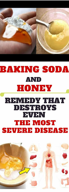 BAKING SODA AND HONEY: REMEDY THAT DESTROYS EVEN THE MOST SEVERE DISEASE