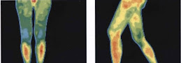 T2 ETS affecting overall ANS function