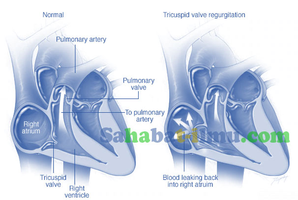 Fungsi Katup Trikuspid (Tricuspid Valve) pada Jantung