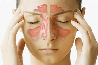 Sinusitis Sinus Infection Illustration Photo Pictures