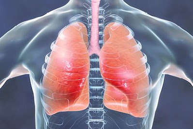 Chronic bronchitis : causes, symptoms, treatment and prevention