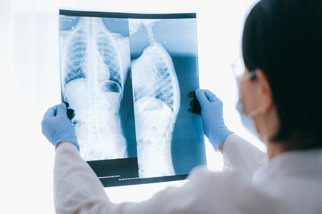 X-Rays: Objectives, Preparation, Procedure, Results, Risks