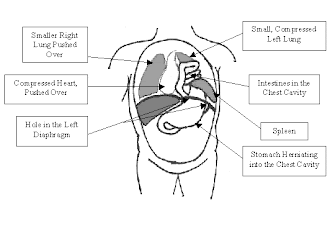What is CDH?
