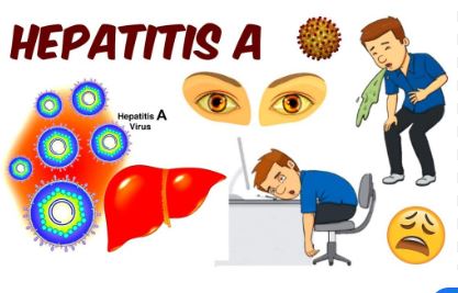 Kerala లో విజృంభిస్తున్న హెపటైటిస్‌ ఎ వైరస్‌
