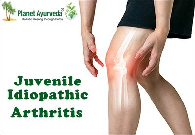 Juvenile Idiopathic Arthritis