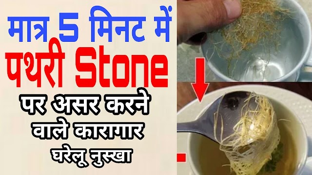 किडनी रोग का उपचार | किडनी स्टोन | kidney stone treatment in hindi