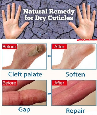 Peeling-cracked-skin-treatment