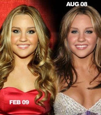 Amanda Bynes before and after photos (image hosted by hanafi-galerycellebritis.blogspot.com)