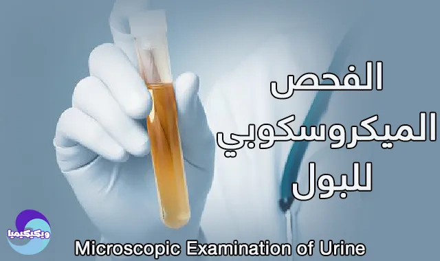 Microscopic Examination of Urine