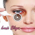 Best Home Remedy To Remove Dark Circles