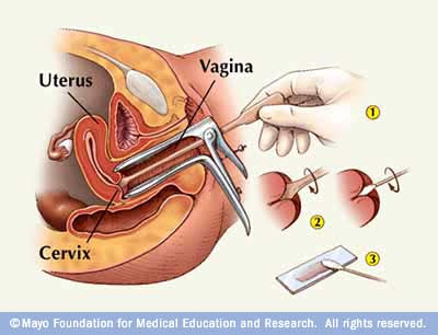 Pap Smear