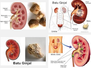 https://meringankangejalabatuginjal.blogspot.co.id/